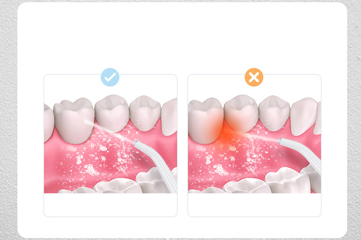 Irigator bucal profesional, dus bucal, Ultra-Portabil, rezervor 220 ml, alb